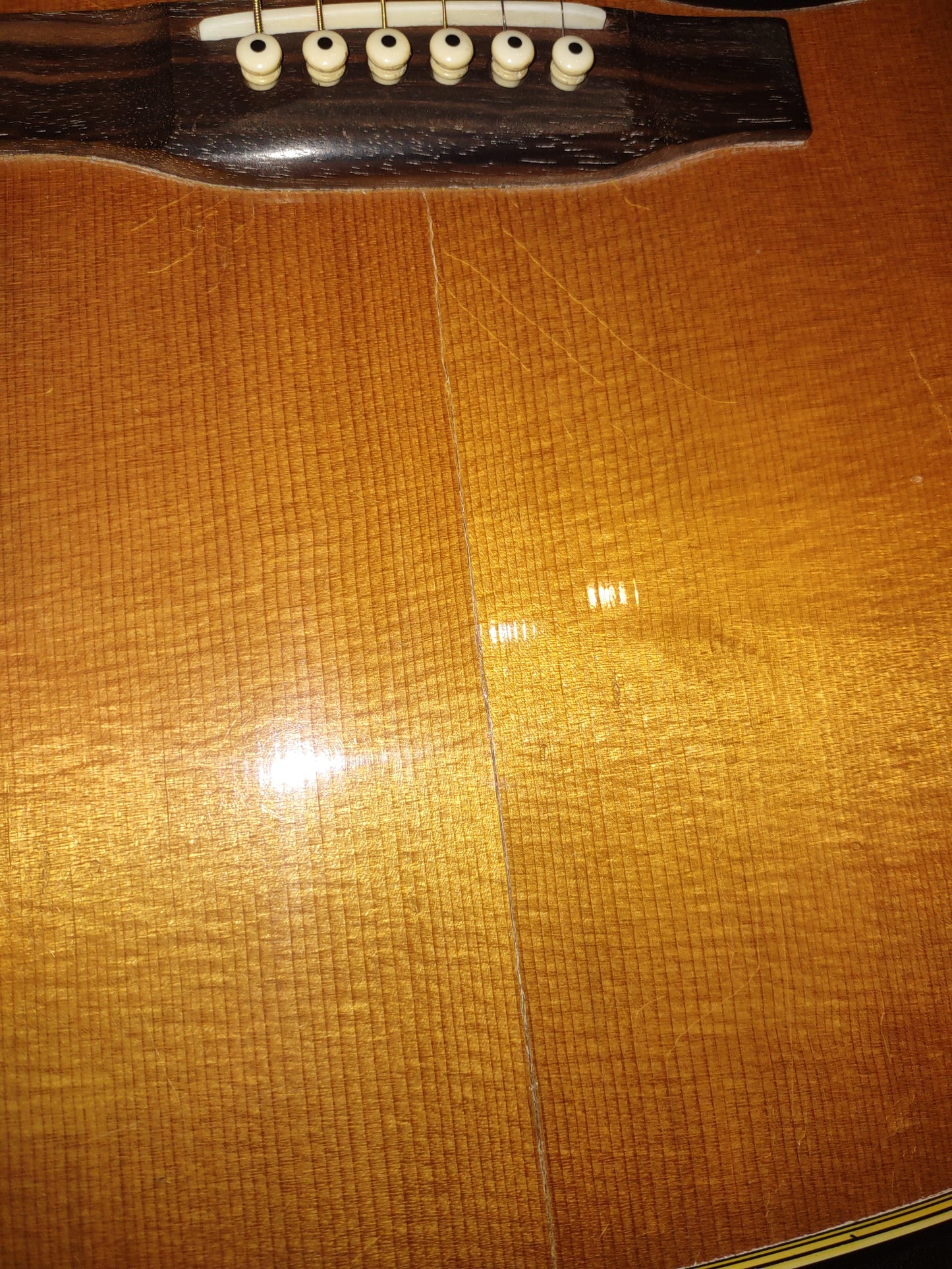 Martin D-35. 1994 with HSC